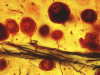 Ganglionic cells  of the trigeminal nucleus of the mouse