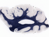 Brain slices