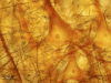 Neurofibrils of a pyramidal neuron