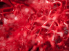 Corrosion cast of brain blood vessels