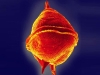 Protoperidinium pellucidum