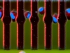 Cancer cells in motion