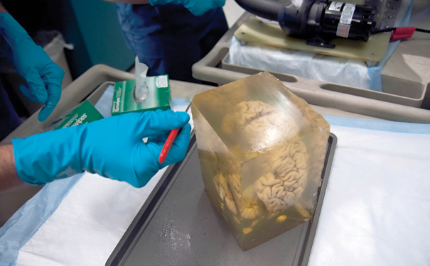 brain