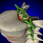 Study shows links between Vitamin D and Multiple Sclerosis