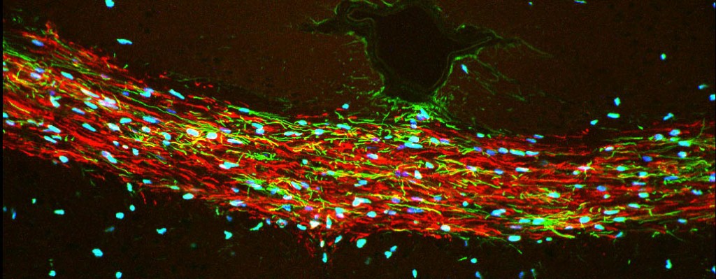Fraser-Sim-Stem-Cells