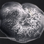 Benthic foraminifera