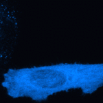 Tracking proteins provides an insight into brain diseases