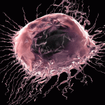 Another genetic key to breast cancer identified