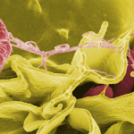 Dangerous salmonella discovered
