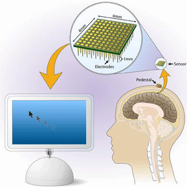 BrainGate1_1