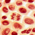Making blood vessels from liposuction fat