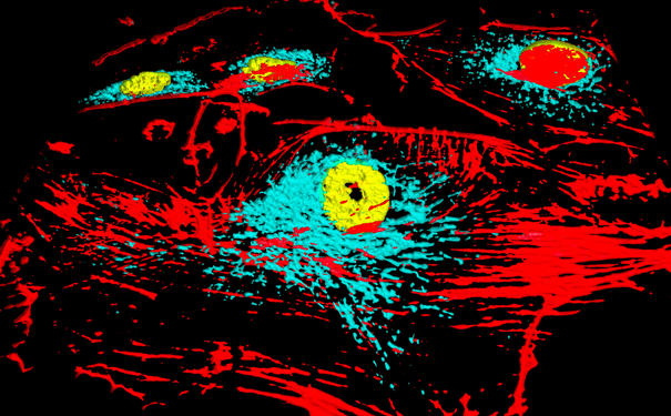 mitochondria