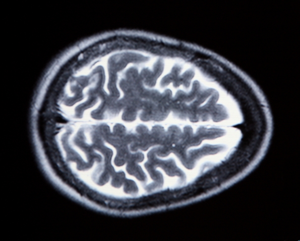 brain